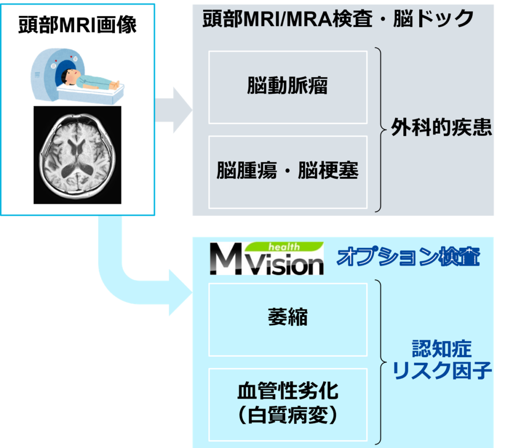 【画像】MRI/MRA検査・脳ドック