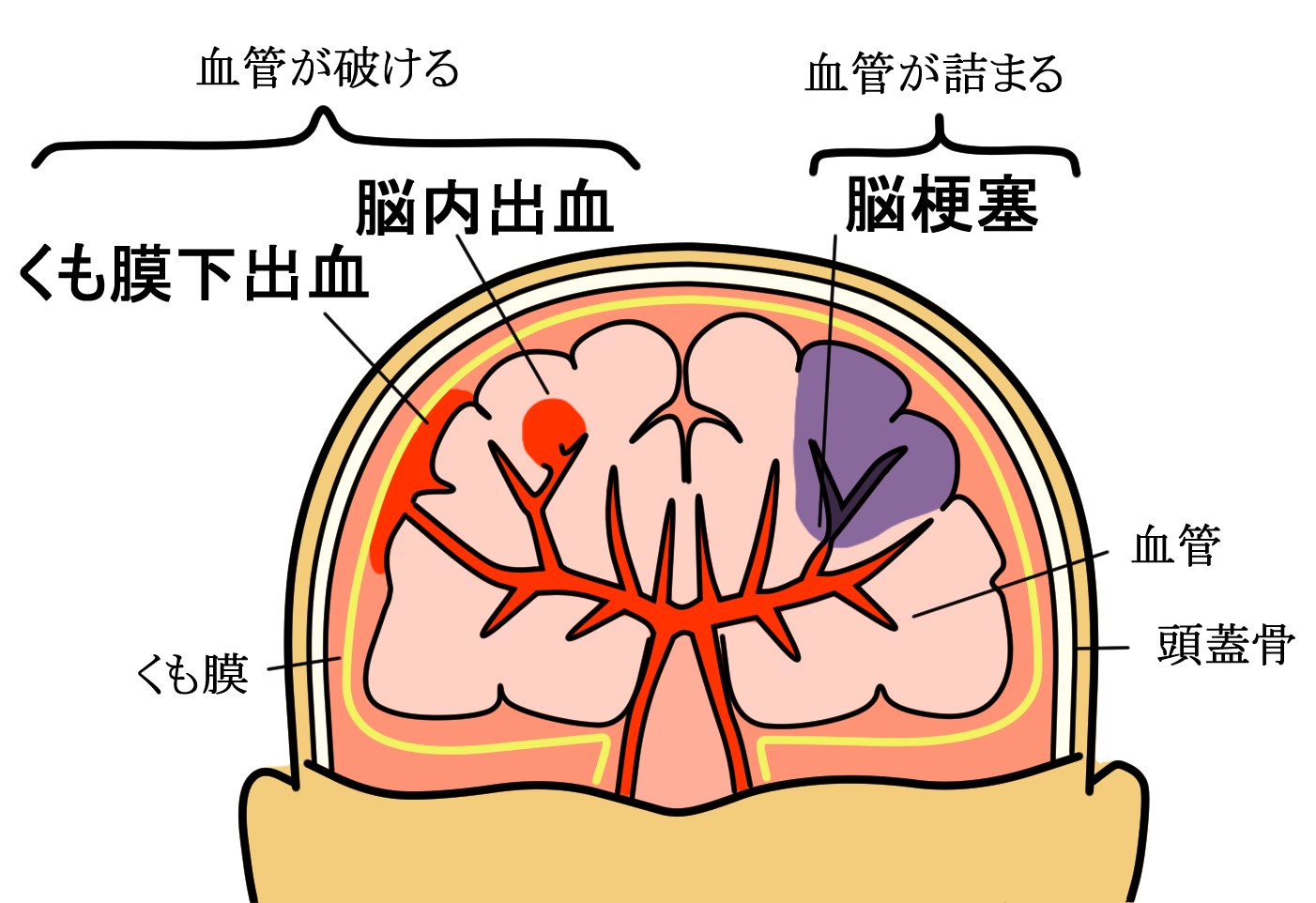 高次脳機能障害のための神経心理学的リハビリテーション 高次脳機能障害のための 神経心理学的リハビリテーション 英国
