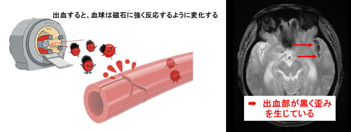 【画像】T2*原理