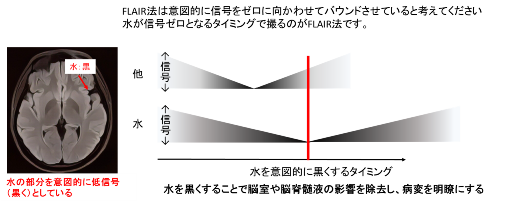 【画像】FLAIR解説