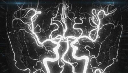 MRIとMRAの違い｜造影剤なしで「命に関わる病気」脳動脈瘤・脳梗塞リスクを見つけるMRA検査とは