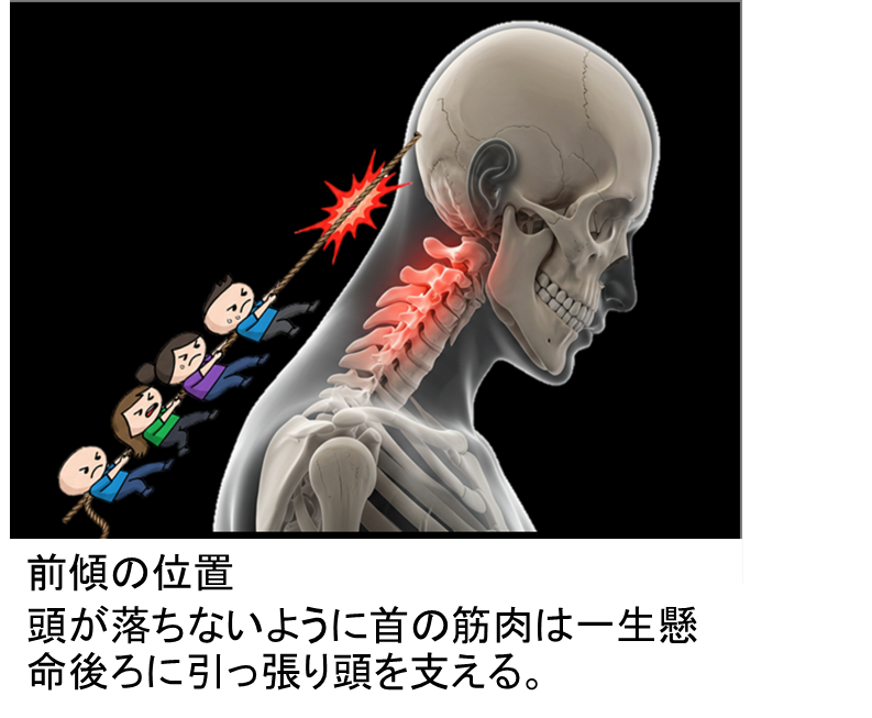 首の負担あり