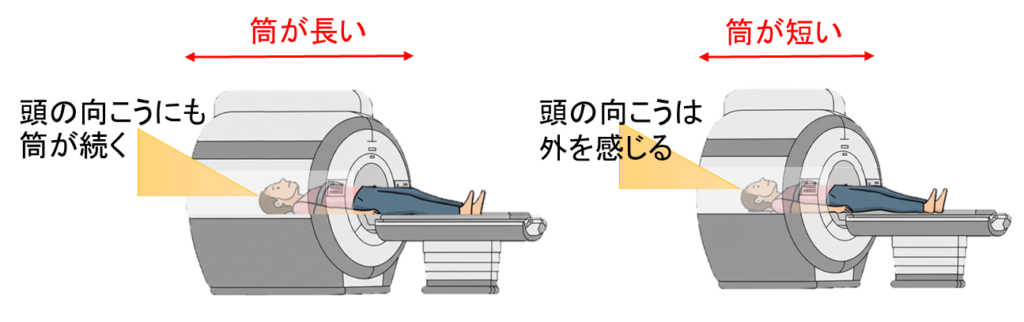 MRIに抱いていたイメージ