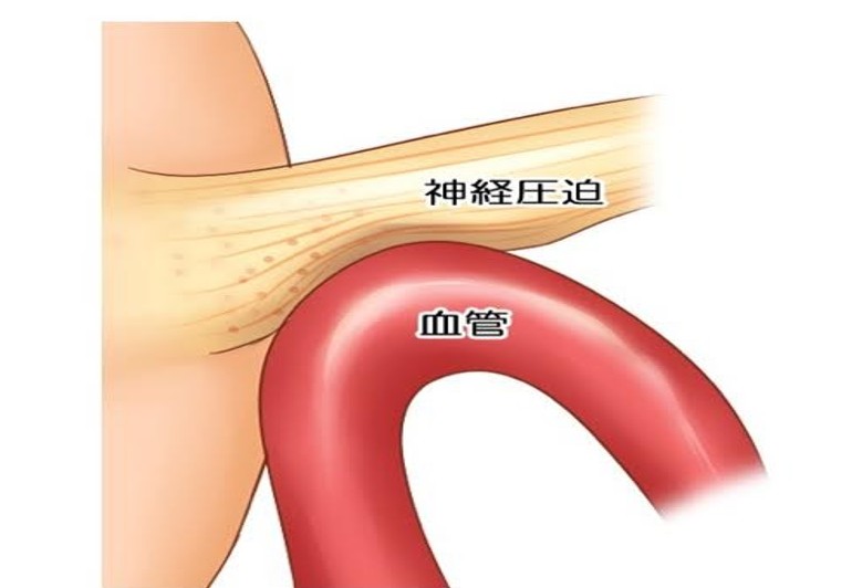 血管と神経　圧迫
