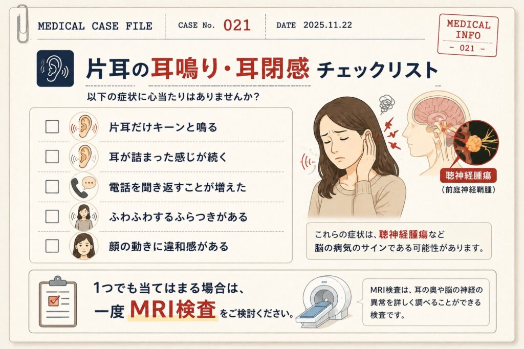 片耳の耳鳴り・耳閉感のセルフチェックをカルテ風に図解。片耳だけの耳鳴り、耳が詰まる感じ、電話を聞き返す、ふらつき、顔の違和感など、聴神経腫瘍の初期サインとMRI検査の重要性を解説したチェックリスト。