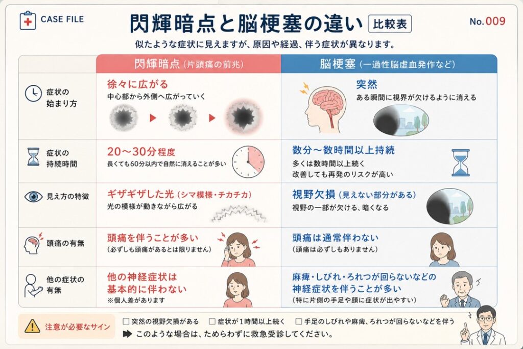 閃輝暗点と脳梗塞の違いを比較したカルテ風図解。閃輝暗点は症状が徐々に広がり、20〜30分程度で改善することが多く、ギザギザした光や頭痛を伴う場合がある一方、脳梗塞では症状が突然始まり、視野欠損が持続し、手足のしびれ・麻痺やろれつが回らないなどの神経症状を伴うことがある。
