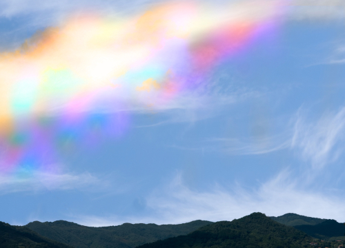 閃輝暗点の典型例