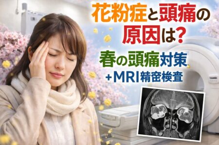 花粉症　頭痛