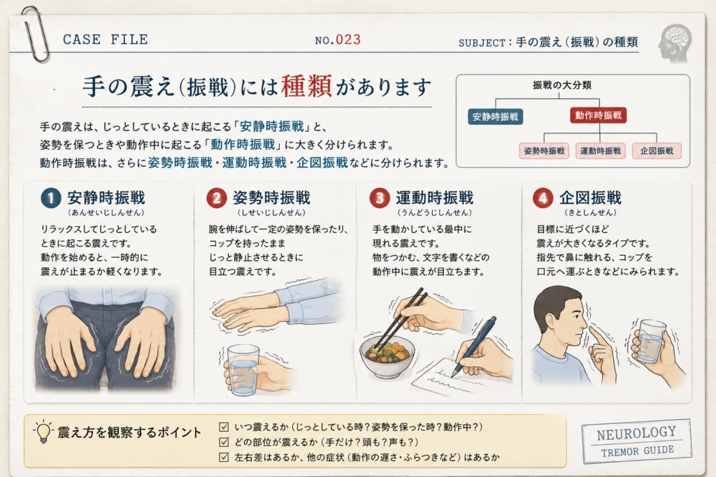 手の震え(振戦)の種類を示した図解。安静時振戦、姿勢時振戦、運動時振戦、企図振戦の特徴と震えが現れるタイミングをイラストで解説。