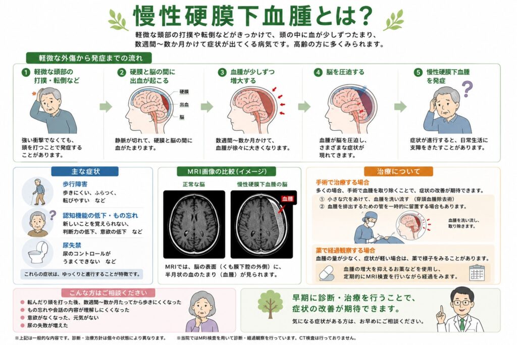 慢性硬膜下血腫について解説した患者向け医療イラスト。軽い転倒や頭部打撲から発症までの流れ、歩行障害・もの忘れ・尿失禁などの主な症状、正常な脳と慢性硬膜下血腫のMRI画像の比較、手術治療と薬による経過観察の選択肢を分かりやすく図解している。軽微な外傷後でも数週間から数か月後に症状が現れることがあり、早期診断・早期治療の重要性を紹介したインフォグラフィック。