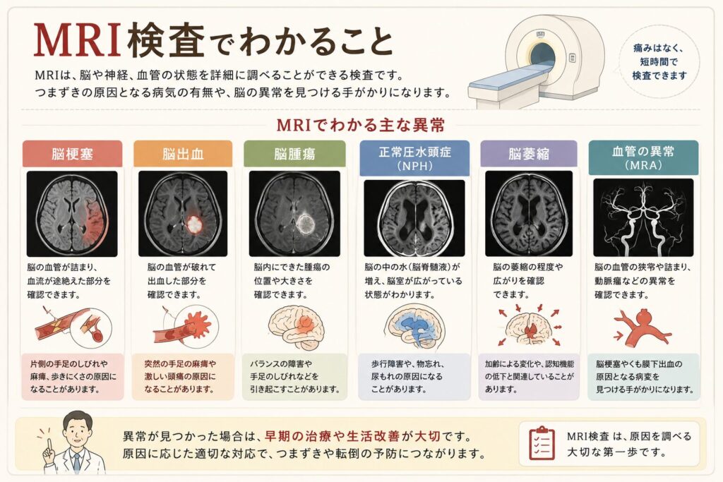 MRI検査でわかる主な病気をまとめた図解。脳梗塞、脳出血、脳腫瘍、正常圧水頭症、脳萎縮、血管の異常(MRA)など、つまずきの原因となる病気をMRIで評価できることを紹介。