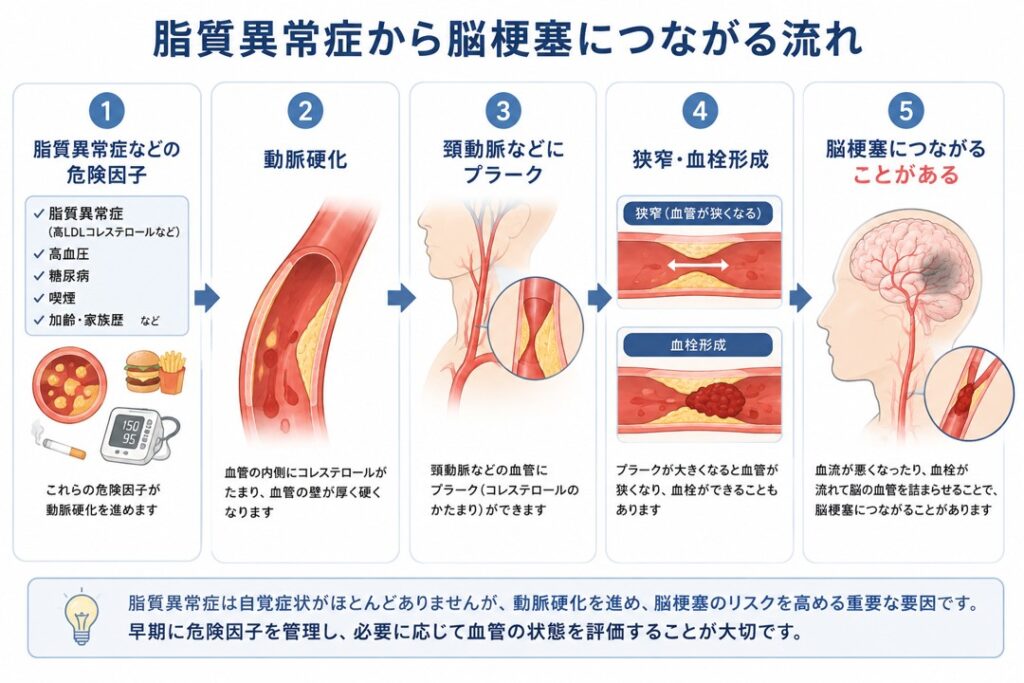 脂質異常症などの危険因子から動脈硬化、頸動脈プラーク、狭窄・血栓形成を経て脳梗塞につながることがある流れを示した図