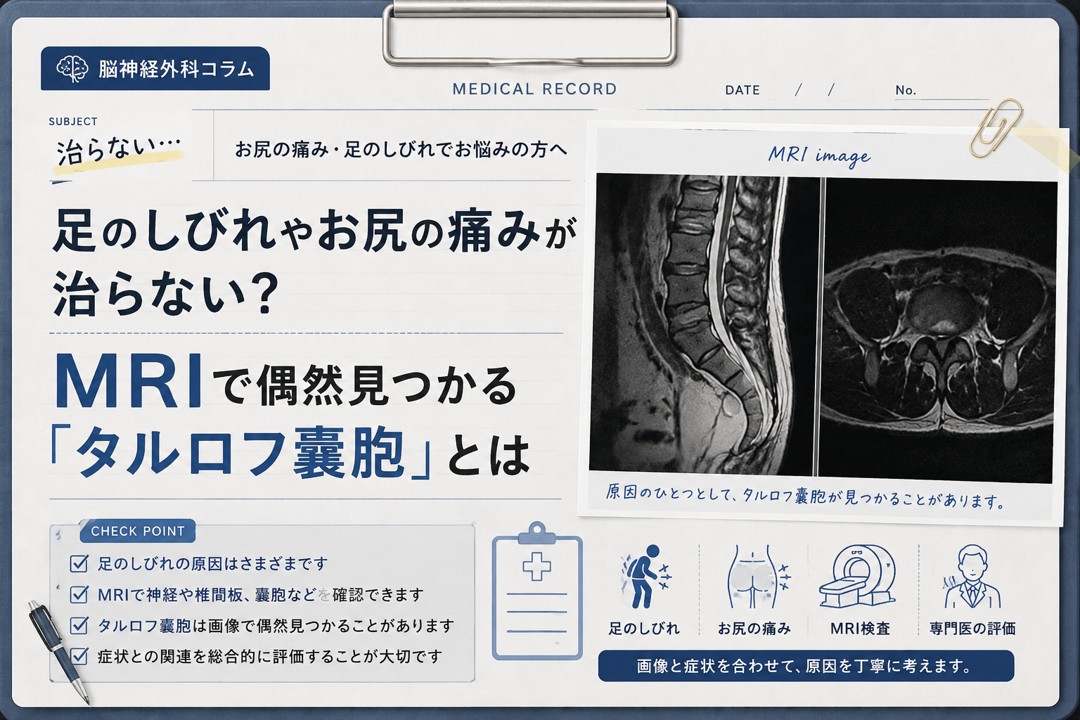 足のしびれやお尻の痛みとMRI検査、タルロフ嚢胞について解説する脳神経外科ブログのイメージ