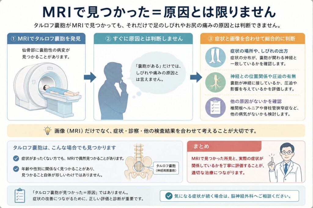 「MRIでタルロフ嚢胞が見つかっても足のしびれやお尻の痛みの原因とは限らず、症状や神経との位置関係、他の原因を合わせて評価することを示した図」
