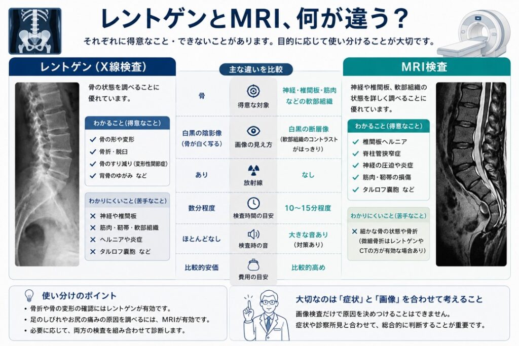 レントゲンとMRIの違いを比較した図。レントゲンは骨の形や変形、骨折などの確認に適し、MRIは神経・椎間板・筋肉などの軟部組織を詳しく確認できることを解説。