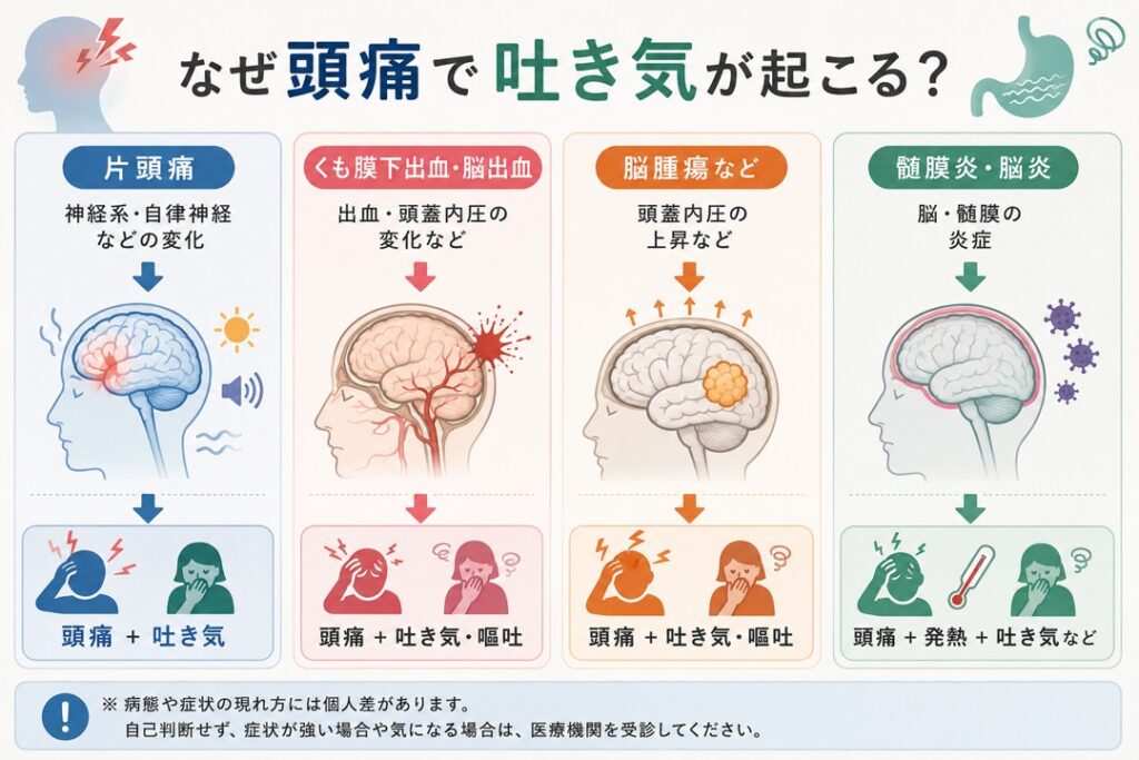 片頭痛や脳出血などで頭痛と吐き気が同時に起こる仕組みを示した図
