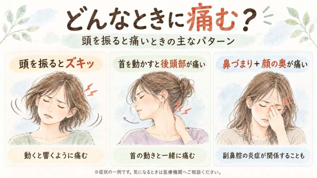 頭を振るとズキッと痛む、首を動かすと後頭部が痛む、鼻づまりとともに顔の奥が痛むなど、頭痛が起こる3つのパターンを比較した図解。